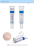 BIOAQUA 30g  Whitening Skin Care Anti Acne Treatment Cream Oil Control Moisturizing Acne Scar Remover Pores  Acne Cream