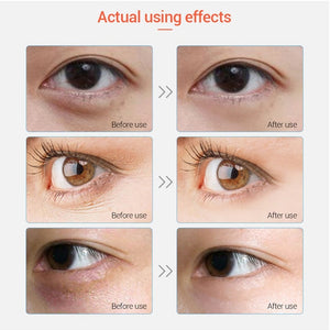 Eye Face Care 5bags Gold Crystal Collagen Eye Mask Patches For The Eye Anti-Aging Anti-Wrinkle Remove Black Eye